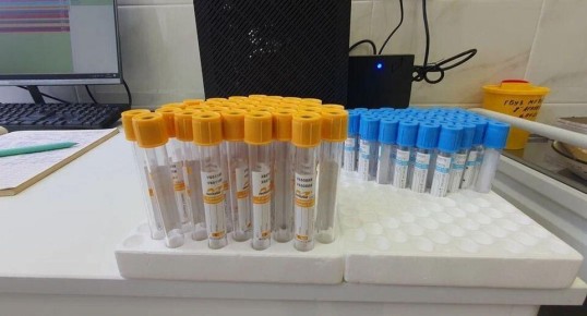 Как правильно интерпретировать анализ на биохимию крови: АСТ и АЛТ в фокусе